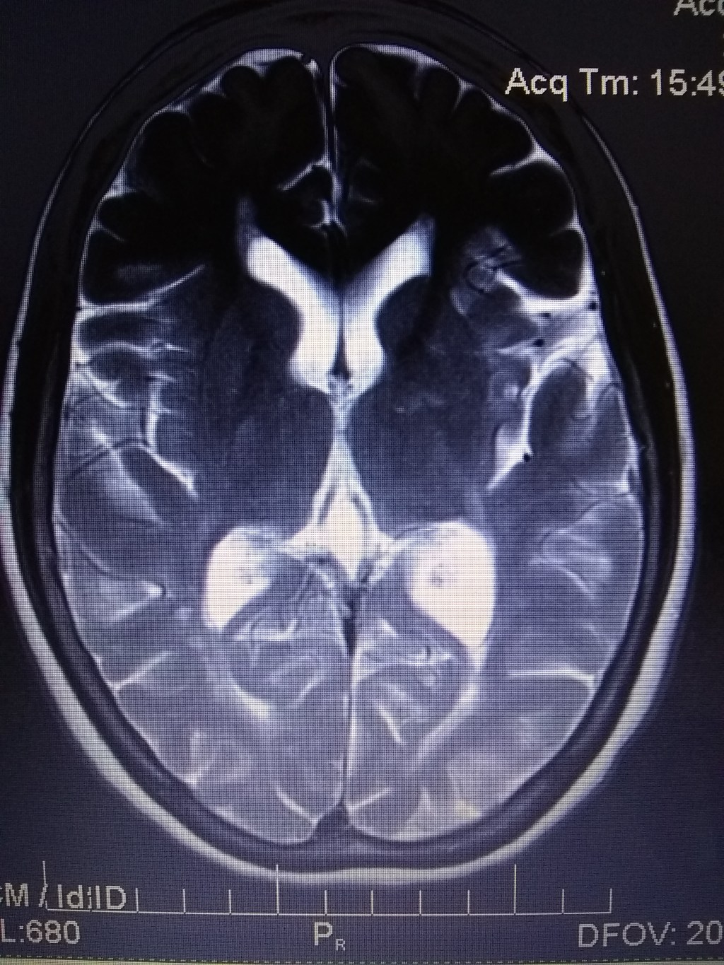 Nuclear Magnetic Resonance&nbsp;Imaging